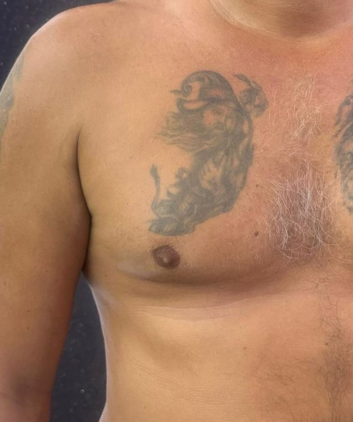 Cover-Up Vorher — Nikita