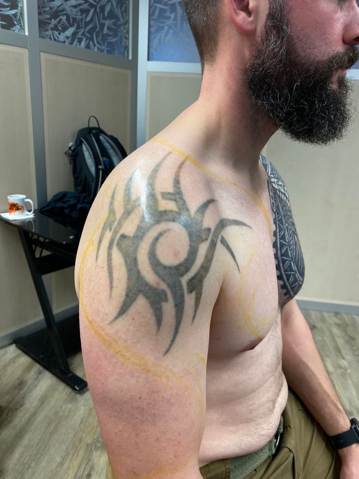 Cover-Up Vorher — Nikita